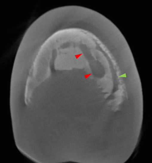 Transverse anotated (1)